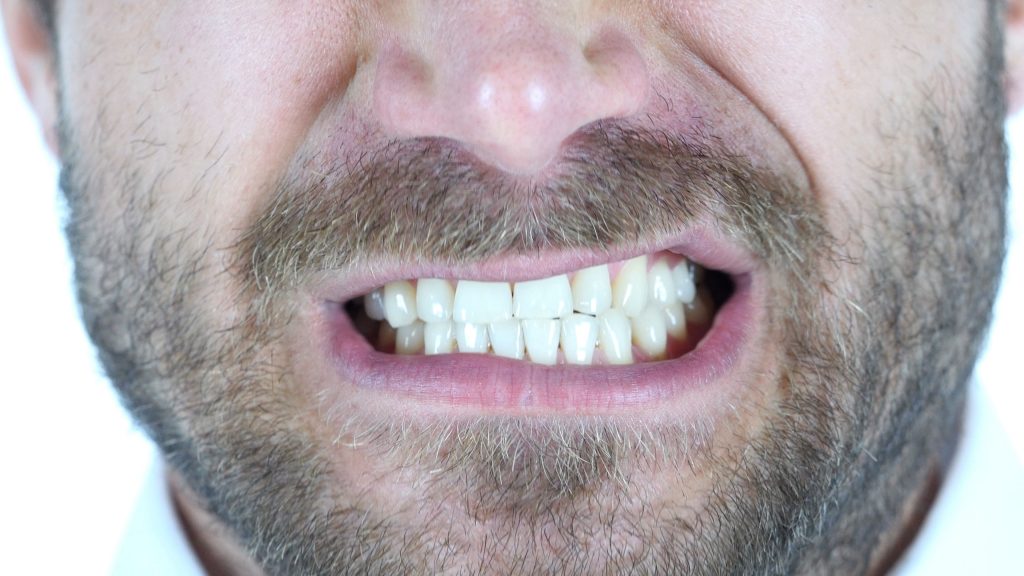 This does not usually cause any harm, but when it happens regularly, bruxism can cause teeth damage, and also other health complications.