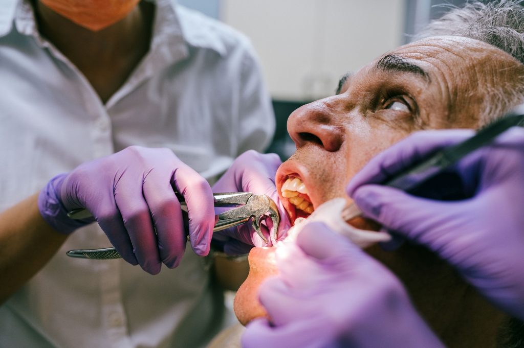 Afraid of tooth extraction? Read our article and hopefully you will feel more comfortable about it! And some useful tips for aftercare.