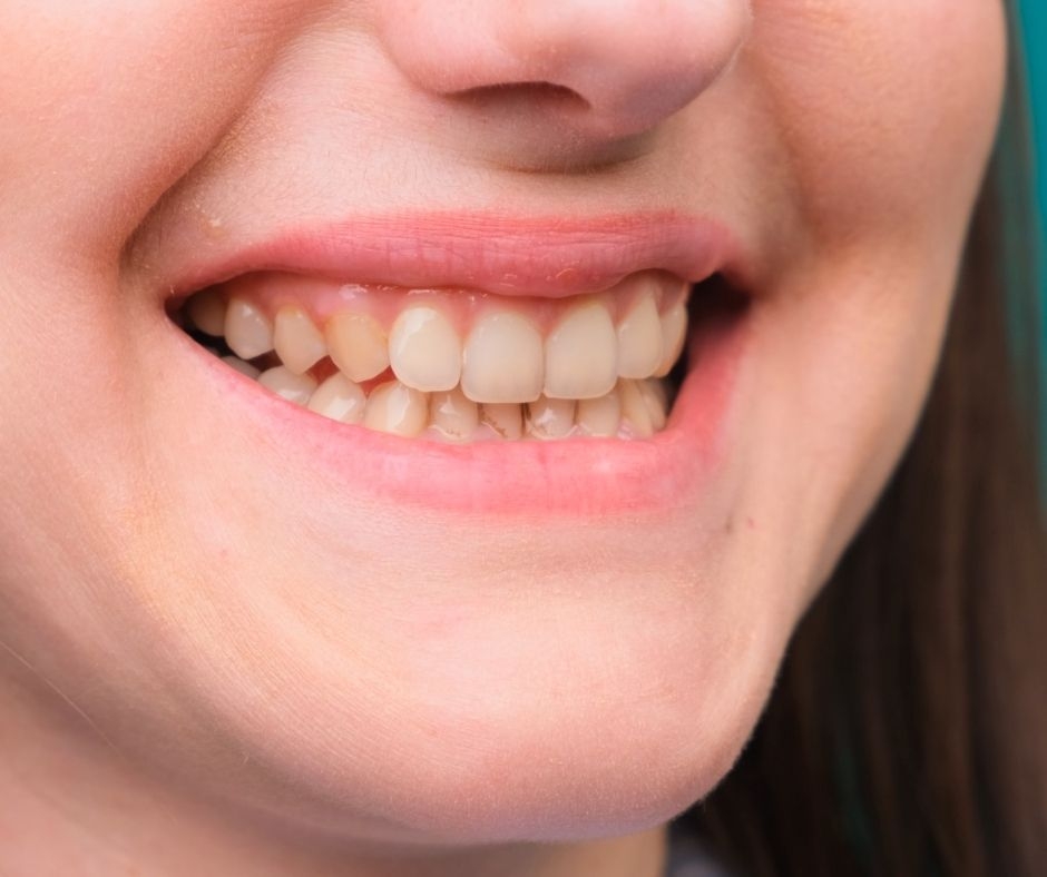 Die negativen Auswirkungen des Rauchens