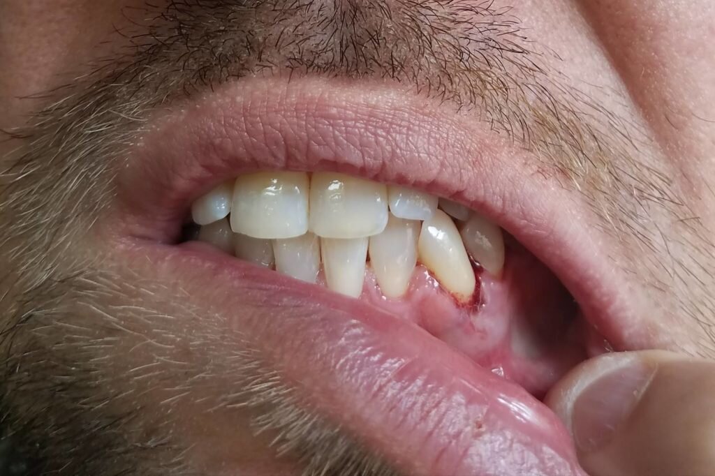 man's nasty bloody gums and tooth