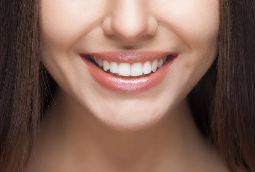 porzellanveneers
